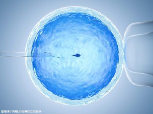 第三代试管婴儿